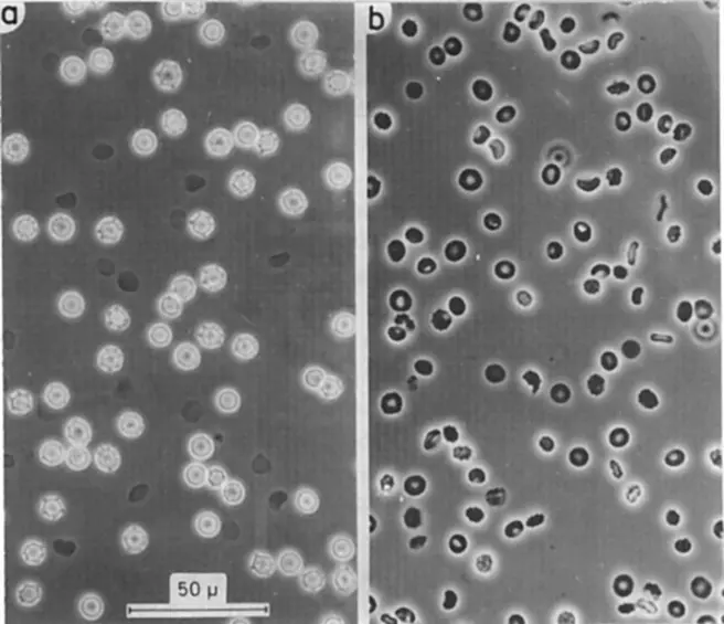 The Phase Contrast microscope View 